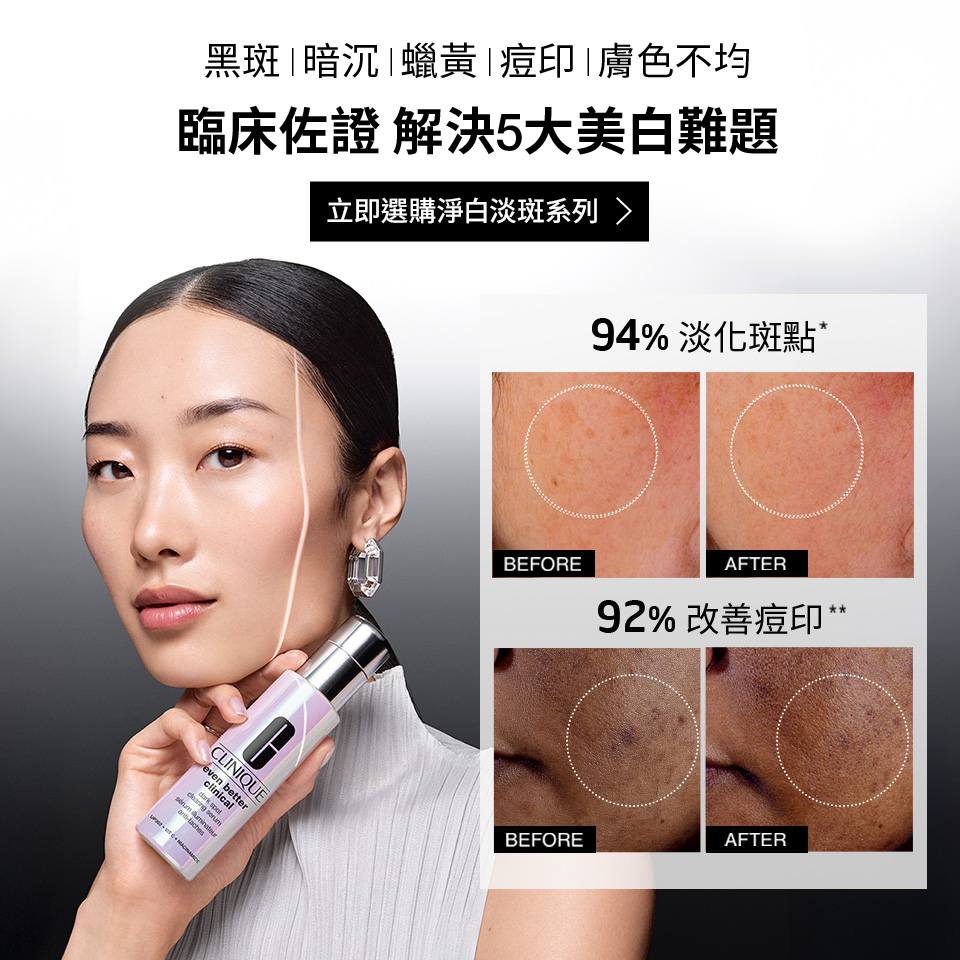 KV-淨白淡斑