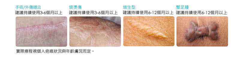 【安適康AnsCare】皙佳疤痕護理矽凝膠/除疤凝膠(7g)