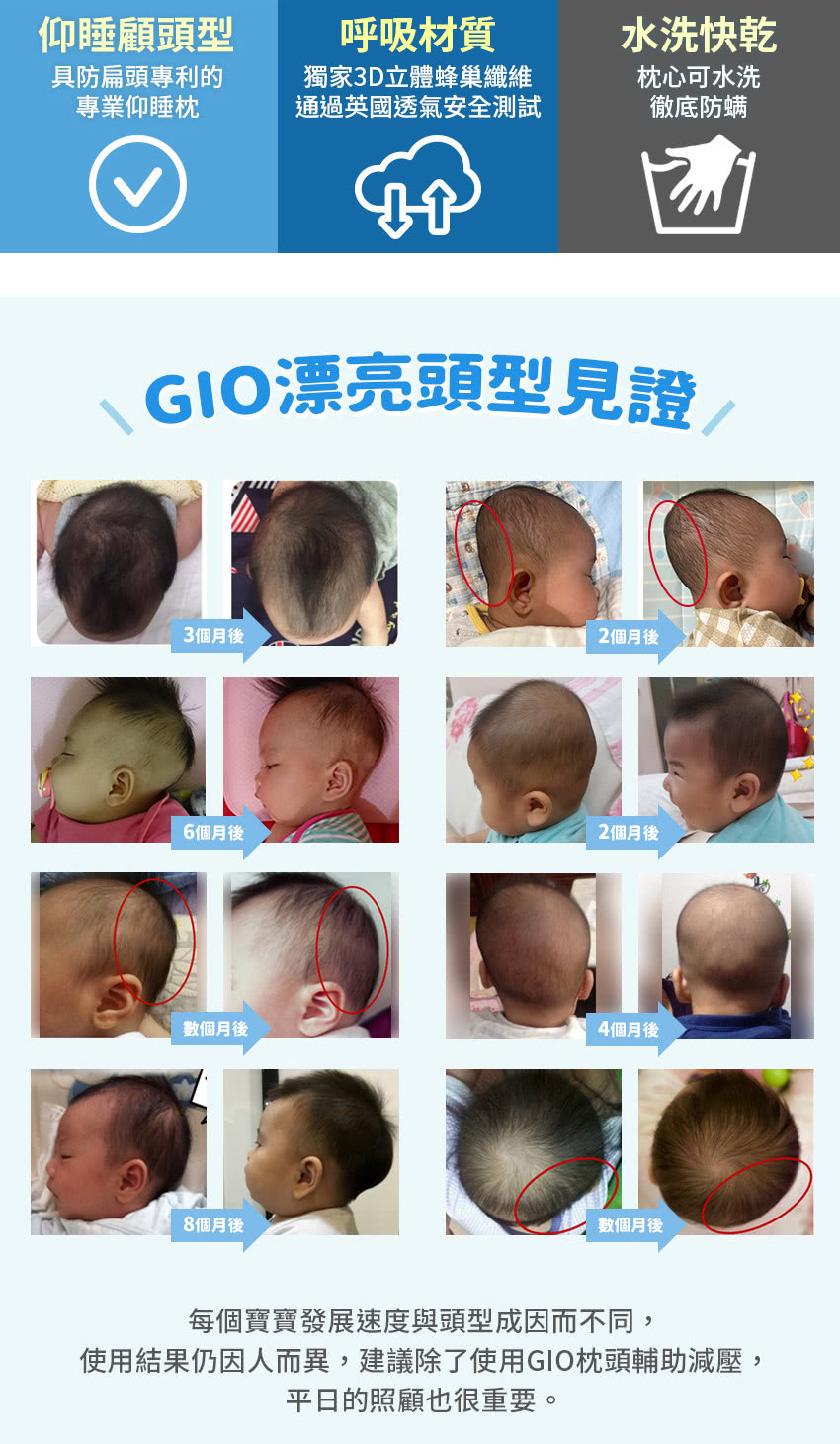 仰睡顧頭型呼吸材質水洗快乾具防扁頭專利的專業仰睡獨家3D立體蜂巢纖維通過英國透氣安全測試枕心可水洗徹底防螨GIO漂亮頭型見證3個月後2個月後6個月後2個月後數個月後4個月後8個月後數個月後每個寶寶發展速度與頭型成因而不同,使用結果仍因人而異,建議除了使用GIO枕頭輔助減壓,平日的照顧也很重要。