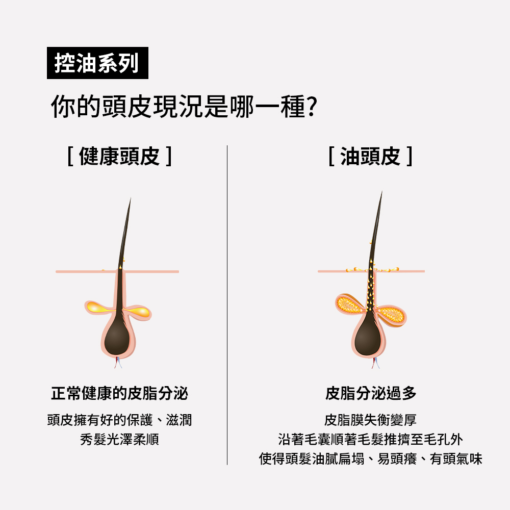 使得頭髮油膩扁塌、易頭癢、有頭氣味