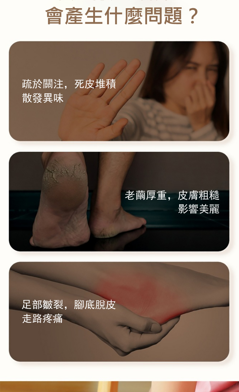 疏於關注,死皮堆積