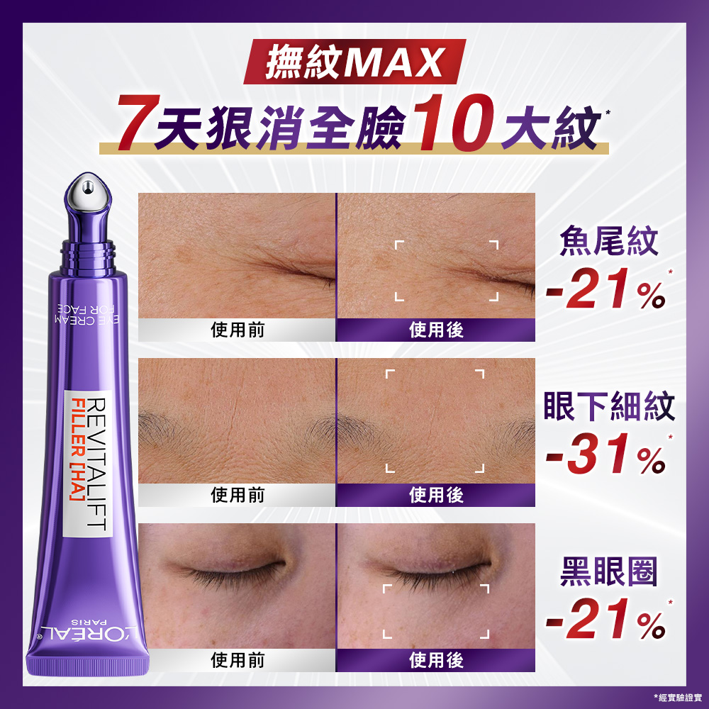 成分升級 擊退眼周問題