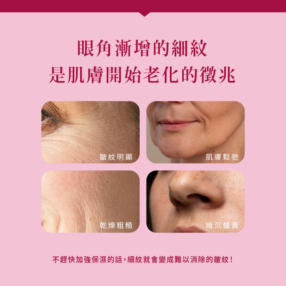 不趕快加強保濕的話,細紋就會變成難以消除的皺紋