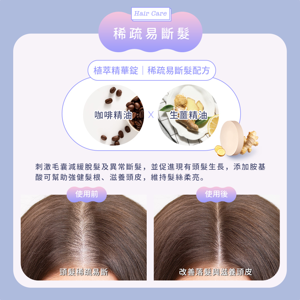 åºæ¿æ¯åæ¸ç·©è«é«®åç°å¸¸æ·é«®,ä¸¦ä¿é²ç¾æé ­é«®çé·,æ·»å èºåº