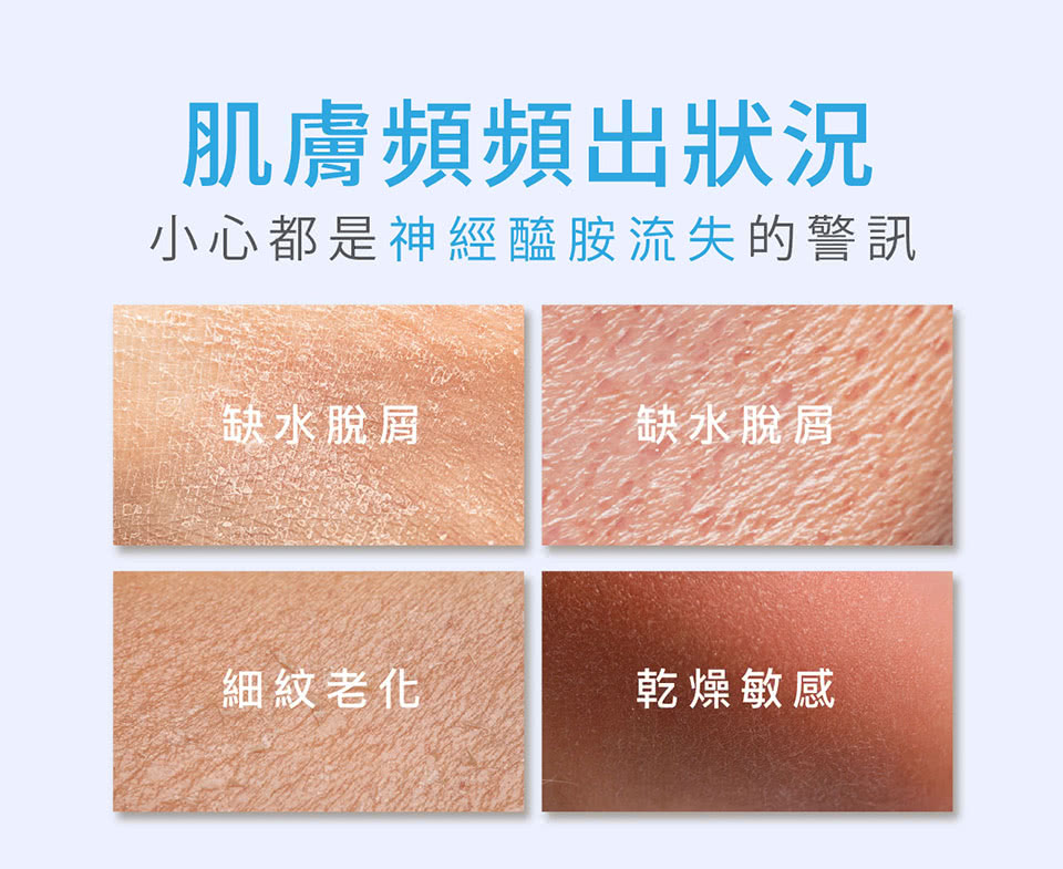 小心都是神經醯胺流失的警訊
